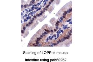 Image no. 2 for anti-Lysyl Oxidase Pro-Peptide (LOPP) (AA 78-115), (Internal Region) antibody (ABIN363571) (LOPP Antikörper  (Internal Region))