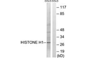 Western blot analysis of extracts from COLO cells, using Histone H1 (Ab-17) Antibody. (Histone H1 Antikörper  (AA 1-50))