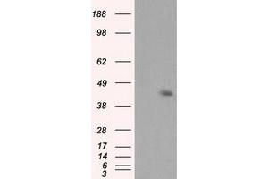 Image no. 3 for anti-Induced Myeloid Leukemia Cell Differentiation Protein Mcl-1 (MCL1) antibody (ABIN1499338) (MCL-1 Antikörper)