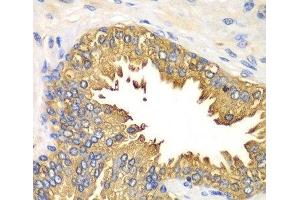 Immunohistochemistry of paraffin-embedded Human prostate using RIG-I / DDX58 Polyclonal Antibody at dilution of 1:100 (40x lens). (DDX58 Antikörper)