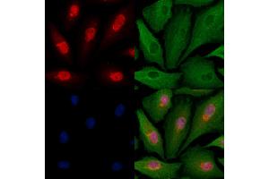 ABIN6263188 and ABIN6279524 staining  cells by IF/ICC. (MED11 Antikörper  (Internal Region))