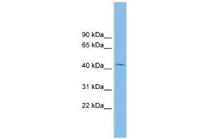 WB Suggested Anti-RIBC1 Antibody Titration: 0. (RIBC1 Antikörper  (Middle Region))