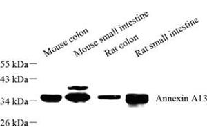 Western blot analysis of Annexin-A13 (ABIN7073062) at dilution of 1: 500 (Annexin A13 Antikörper)