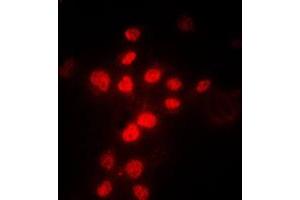 Immunofluorescent analysis of MLH1 staining in HeLa cells. (MLH1 Antikörper  (Center))