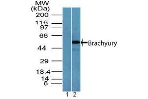 Image no. 2 for anti-T Brachyury Protein (AA 350-400) antibody (ABIN960367) (T Brachyury Protein (AA 350-400) Antikörper)