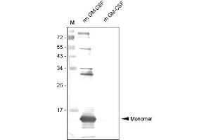 Western Analysis of anti-Mouse GM-CSF Antibody . (GM-CSF Antikörper  (AA 18-141))