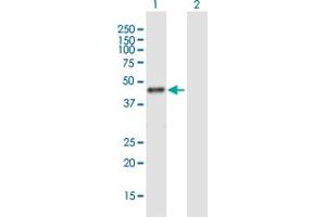 Western Blot analysis of RRM2 expression in transfected 293T cell line ( H00006241-T01 ) by RRM2 MaxPab polyclonal antibody. (RRM2 Antikörper  (AA 1-389))