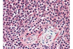 Human Spleen (formalin-fixed, paraffin-embedded) stained with APAF1at 10 µg/ml followed by biotinylated goat anti-rabbit IgG secondary antibody, alkaline phosphatase-streptavidin and chromogen. (APAF1 Antikörper  (C-Term))