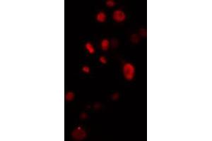 ABIN6274504 staining Hela cells by IF/ICC. (ZNF541 Antikörper  (Internal Region))