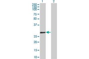 Western Blot analysis of GSTO1 expression in transfected 293T cell line by GSTO1 polyclonal antibody (A01).
