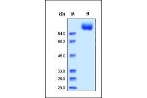 SDS-PAGE (SDS) image for VEGF Receptor 2 (VEGFR2) (AA 20-764) (Active) protein (His tag) (ABIN6253722)