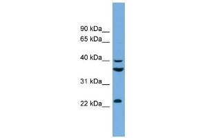 WB Suggested Anti-SAE1 Antibody Titration: 0. (SAE1 Antikörper  (N-Term))