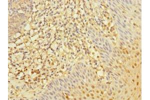 Immunohistochemistry of paraffin-embedded human tonsil tissue using ABIN7167590 at dilution of 1:100 (RGS1 Antikörper  (AA 1-181))