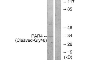 Western blot analysis of extracts from 3T3 cells, treated with etoposide (etoposide, 1hour), using PAR4 (Cleaved-Gly48) antibody. (F2RL3 Antikörper  (Cleaved-Gly48, N-Term))