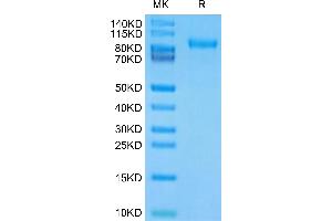 SDS-PAGE (SDS) image for LI Cadherin (AA 23-667) protein (His tag) (ABIN7274308)