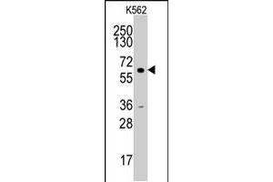 Western blot analysis of CCNA2 polyclonal antibody  in HL-60 cell line lysates (35 ug/lane). (Cyclin A Antikörper  (N-Term))