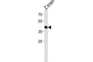 Western Blotting (WB) image for anti-Transcription Factor AP-2 epsilon (Activating Enhancer Binding Protein 2 Epsilon) (TFAP2E) antibody (ABIN3004620)