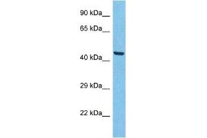 Host:  Rabbit  Target Name:  ACHB3  Sample Type:  A549 Whole Cell lysates  Antibody Dilution:  1. (ACHB3 Antikörper  (N-Term))