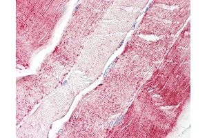 Human, Skeletal muscle: Formalin-Fixed Paraffin-Embedded (FFPE). (XYLT2 Antikörper  (AA 722-771))