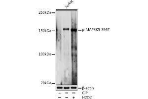 Western blot analysis of extracts of Jurkat cells, using Phospho-MK5-S967 antibody (ABIN7268655) at 1:1000 dilution. (ASK1 Antikörper  (pSer967))