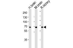 Western Blotting (WB) image for anti-Glutaminase (GLS) (AA 516-545), (C-Term) antibody (ABIN652757)