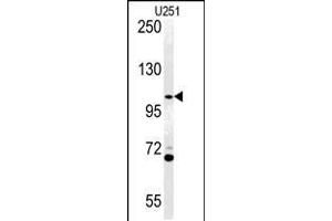 Western blot analysis of ACAP3 Antibody in U251 cell line lysates (35ug/lane) (Acap3 Antikörper  (N-Term))