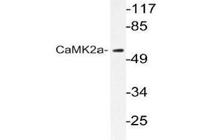 Western blot (WB) analyzes of CaMK2-a antibody in extracts from A431 cells. (CAMK2A Antikörper)