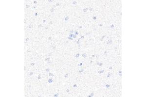 Immunohistochemistry of paraffin-embedded Human brain (negative control sample) using CD7 antibody (ABIN7266214) at dilution of 1:10000 (40x lens). (CD7 Antikörper)