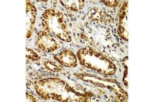 Immunohistochemistry of paraffin-embedded human kidney using SMAD9 antibody (ABIN5975592) at dilution of 1/100 (40x lens). (SMAD9 Antikörper)