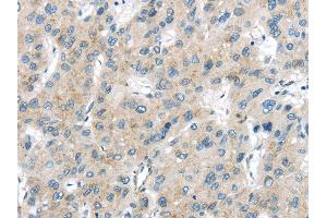 Immunohistochemistry (IHC) image for anti-Vacuolar Protein Sorting-Associated Protein 26A (VPS26A) antibody (ABIN5959956) (VPS26A Antikörper)