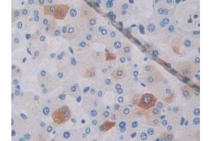 Immunohistochemistry (IHC) image for anti-ATP-Binding Cassette, Sub-Family A (ABC1), Member 1 (ABCA1) (AA 1385-1663) antibody (ABIN7433309)