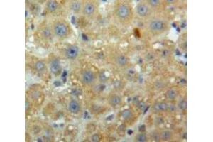 IHC-P analysis of Liver tissue, with DAB staining. (PCSK9 Antikörper  (AA 156-461))