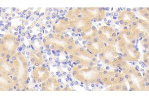 Immunohistochemistry (IHC) image for anti-Glutaminase (GLS) (AA 31-253) antibody (ABIN7436600)