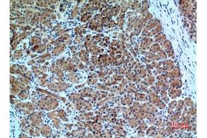 Immunohistochemistry (IHC) analysis of paraffin-embedded Human Pancreas, antibody was diluted at 1:100. (CXCR6 Antikörper  (N-Term))