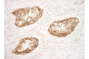 Immunohistochemistry (IHC) image for anti-Vinculin (VCL) (AA 1016-1066) antibody (ABIN7448859)