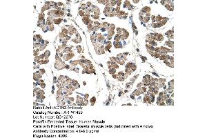 Rabbit Anti-ACTN2 Antibody  Paraffin Embedded Tissue: Human Muscle Cellular Data: Skeletal muscle cells Antibody Concentration: 4. (ACTN2 Antikörper  (C-Term))