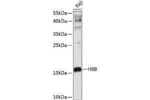 Western blot analysis of extracts of Raji cells, using HBB antibody (ABIN6133523, ABIN6141639, ABIN6141641 and ABIN6217257) at 1:1000 dilution. (Hemoglobin Subunit beta Antikörper  (AA 1-147))