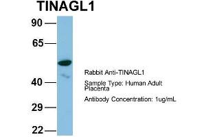 Host: Rabbit Target Name: CHAD Sample Type: Human Adult Placenta Antibody Dilution: 1. (TINAGL1 Antikörper  (Middle Region))