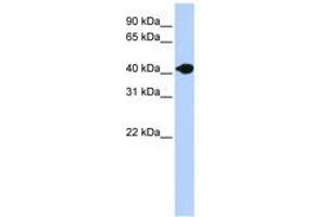 Image no. 1 for anti-Deoxyribonuclease II beta (DNASE2B) (AA 36-85) antibody (ABIN6740776) (DNASE2B Antikörper  (AA 36-85))