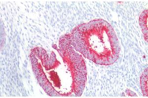 Immunohistochemistry (Paraffin-embedded Sections) (IHC (p)) image for anti-Fucosyltransferase 4 (Alpha (1,3) Fucosyltransferase, Myeloid-Specific) (FUT4) antibody (ABIN5526904)