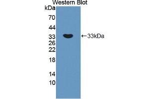 Western blot analysis of the recombinant protein. (APBA2 Antikörper  (AA 459-722))