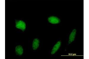 Immunofluorescence of purified MaxPab antibody to STAT5A on HeLa cell. (STAT5A Antikörper  (AA 1-794))