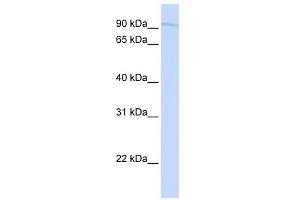 SYDE1 antibody used at 1 ug/ml to detect target protein. (SYDE1 Antikörper)