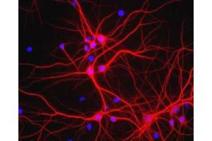 Immunofluorescence - MAP2 Antibody. (MAP2 Antikörper)