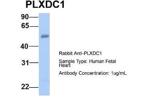 Host:  Rabbit  Target Name:  PLXDC1  Sample Type:  Human Fetal Heart  Antibody Dilution:  1. (PLXDC1 Antikörper  (N-Term))