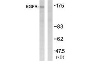 Western blot analysis of extracts from HuvEc cells, using EGFR (Ab-1092) Antibody. (EGFR Antikörper  (AA 1061-1110))