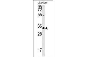 ZFYVE27 Antibody (N-term) (ABIN1539257 and ABIN2848777) western blot analysis in Jurkat cell line lysates (35 μg/lane). (ZFYVE27 Antikörper  (N-Term))