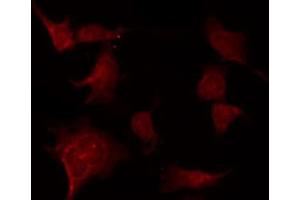 Immunofluorescence (fixed cells) (IF/ICC) image for anti-Caspase 3 (CASP3) (pSer150) antibody (ABIN6254994)