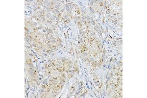 Immunohistochemistry (IHC) image for anti-Matrix Metallopeptidase 3 (Stromelysin 1, Progelatinase) (MMP3) (AA 248-477) antibody (ABIN3021709)