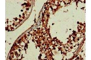 Immunohistochemistry of paraffin-embedded human testis tissue using ABIN7149738 at dilution of 1:100